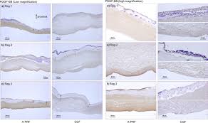 After calculation you can multiply the result by. A Technical Note On Contamination From Prf Tubes Containing Silica And Silicone Bmc Oral Health Full Text