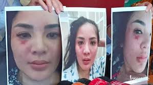 Suami nindy ayunda, askara parasady harsono akhirnya menampakkan wajahnya setelah diciduk polisi atas simpan sabu dan senpi suami nindy ayunda ditangkap polisi, nindy jatuh sakit ~ gosip artis hari ini. Alami Kdrt Hingga Diselingkuhi Nindy Ayunda Berusaha Maafkan Suami