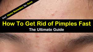 8 Great Home Remedies To Get Rid Of Pimples Fast