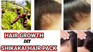Hair experts recommend using hair regrowth products as per the hair loss type. Shikakai Hair Mask For Rapid Hair Growth Stop Hair Fall Turn Grey Hair To Black Permanently Youtube