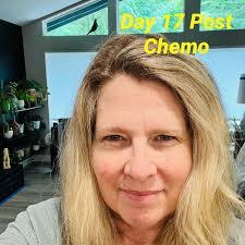 Jax has been growing and is now as tall as Sarah and will catch up with  Jason and me in the next 6mo the. Yikes! He got his top braces off today