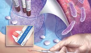 Image result for Tuberculosis Screening