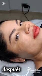 Descubre el poder de la micropigmentación labial 💄✨. ¡Mira el increíble  antes y después de nuestra cliente! 😍 Con nuestra técnica profesional con  productos de alta calidad, podemos realzar la belleza ...
