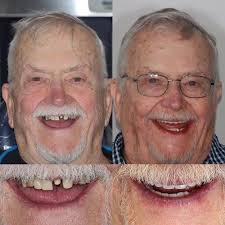 Local oral surgeons give back in 'Smiles for Soldiers' program