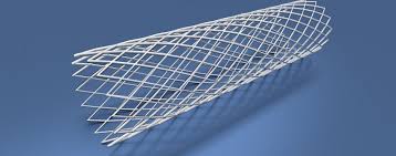 Ballondilatation Und Stentimplantation Herzerfrischend