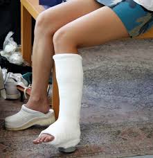 Image result for Short Leg Cast