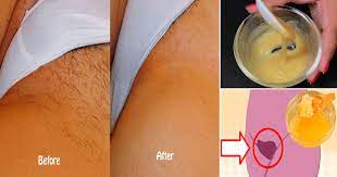 How to shave your vagina + demo! Can I Remove Pubic Hair Permanently