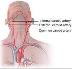 Zones of the neck vector i̇llustration. Major Arteries Of The Head And Neck Flashcards Cram Com