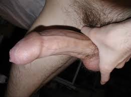 Phimosis before circumcision - ThisVid.com