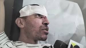 Líder comunitario Jairo Rivas resultó herido, víctima de un asalto en  Dajabón