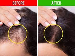 Include necessary vitamins b, c, and minerals such as zinc, iron and copper in your diet. 9 Ways You Can Add More Volume To Thin Hair
