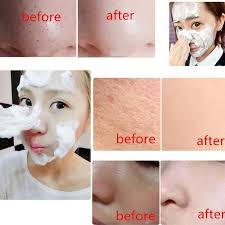 Face Whitening Soap For Dark Skin Spots Scars Snow White Soap For Skin Whitening Bamboo Charcoal Back Neck Body Skin Care Soap Soap Aliexpress