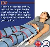 What is EECP Therapy, EECP Treatment - Oplus Heart Centre