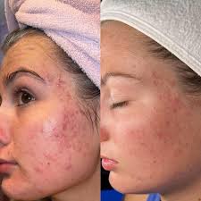 Literally almost cried! This was 3 weeks