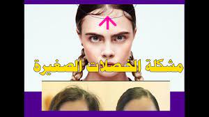 كيف تتخلصي من البيبي هير في التسريحات هيرستايل هند مبروك thumbs up