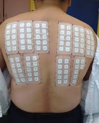 acd a z of skin allergy patch testing