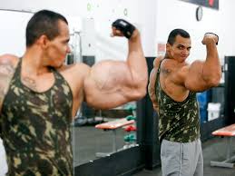H ad the man missed the muscle and injected the oil into a vein, it could have formed a lethal embolism in his vital organs. Brazilian Bodybuilder Claims Synthetic Material Brought Huge Muscles But Also Medical Danger Abc News