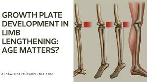 Image result for Growth Plate