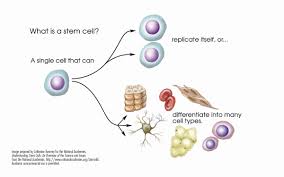 Deoarece celulele stem transplantate in neostriat produc mai putina dopamina decat este nevoie si nu previn perderea acesteia boala huntington  este o boala neurodegenerativa documents similar to utilizarea celulelor stem in tratarea bolilor neurologice. Celule Stem AdevÄƒr Sau Stoarcere De Bani Arhiblog