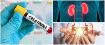 Tomar creatinina de nuevo para descartar problemas renales.