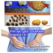 Cara menghancurkan batu mp3 duration 9:22 size 21.44 mb / ikram rauhi 8. Pusat Bekam Azzahra Subang Bestari 0172378001 Batu Karang Penyakit Bahaya Menyerang Secara