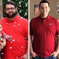 But over the weekend, alexis' heartbreaking battle went viral after. How Does Gastric Sleeve Work Jet Medical Tourism In Mexico