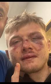 Marvin looking pretty good for absorbing all those shots : r/ufc