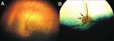 Fundus Appearance Of A Sards Dog A And A Healthy Control Dog B Download Scientific Diagram