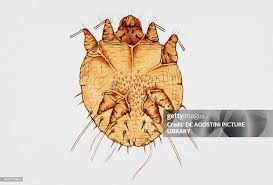 Image result for Sarcoptes scabiei