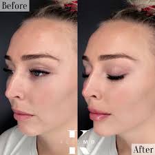 Keys MD Cosmetic Clinic