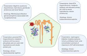 It may cause kidney damage, kidney failure, and high blood pressure. Frontiers Biomarkers And Diagnostic Testing For Renal Disease In Sjogren S Syndrome Immunology