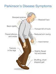 Et is approximately eight times more common than pd, and there are several other differences between the two conditions. Parkinson S Disease Exam Stanford Medicine 25 Stanford Medicine