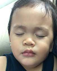 Tanpa persediaan yang rapi, pesalah ini pastinya mengalami jangkitan kuman yang serius, kecederaan. Jangan Ambil Mudah Jika Anak Jatuh Kepala Dahulu Lakukan Segera Tip Yang Dikongsikan Dr Halina Ni Keluarga