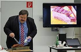 Übergewicht führt irgendwann einmal zu gravierenden gesundheitlichen problemen wie bluthochdruck oder diabetes und so weiter. 56im7obkeemsrm