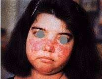 HISTORY TAKING -- ANAMNESIS