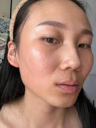 皇妍分享204～臉型的幼態感很多客人在諮詢時，都會詢問臉部如何能呈現幼態感？ 臉部幼態感的改變，不外乎是： 動、靜態紋路少一點