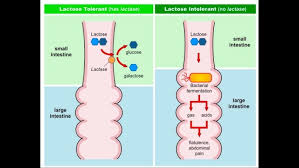 Image result for Lactase Deficiency