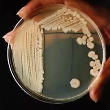 Interpreting Plates Petri Dishes Science Fair Projects Microbiology