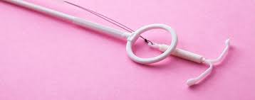 Die kupferkette ist eine variante der kupferspirale, die zur empfängnisverhütung in die gebärmutter eingesetzt wird. Hormonspirale Focus Arztsuche