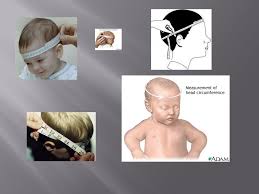 Check spelling or type a new query. Sr42 Bmi Tape Wide 14 Mm Length 1 5 M Ppt Download