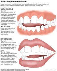 Speech Therapists Expand Tongue Work Speech Therapist Orofacial Myofunctional Therapy Myofunctional Therapy