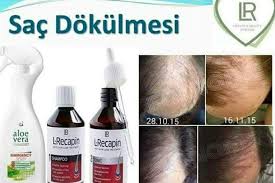 Kellik Artik Kaderiniz Degil Gec Kalmaktan Korkun L Recapin Ile Saclariniz Canlansin Aloe Guzellik Saglik