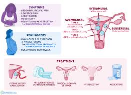 There are two main types of uterine cancer. Leiomyoma Of Uterus Uterine Fibroid What Is It Causes Types Diagnosis Treatment And More Osmosis