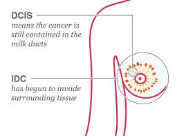 Pin On Surgery