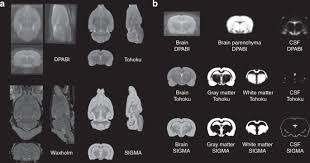 Maybe you would like to learn more about one of these? The Sigma Rat Brain Templates And Atlases For Multimodal Mri Data Analysis And Visualization Nature Communications