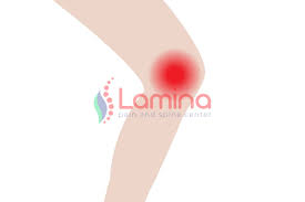 We did not find results for: Cedera Penyebab Utama Lutut Bengkak Ini Solusinya Klinik Patella