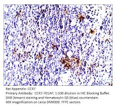 Ccr7, also known as cd197, is a chemokine receptor that binds ccl19 and ccl21. Anti Ccr7 Antikorper A54961 Antibodies Com