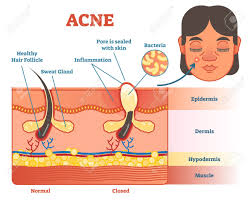 Pimple Diagram Face Wiring Diagrams