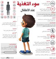 سوء التغذية عند الأطفال صحيفة مكة انفوجرافيك صحة baby health health fitness nutrition baby education