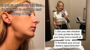 Realtor shows tumor progression and discovers she has CANCER